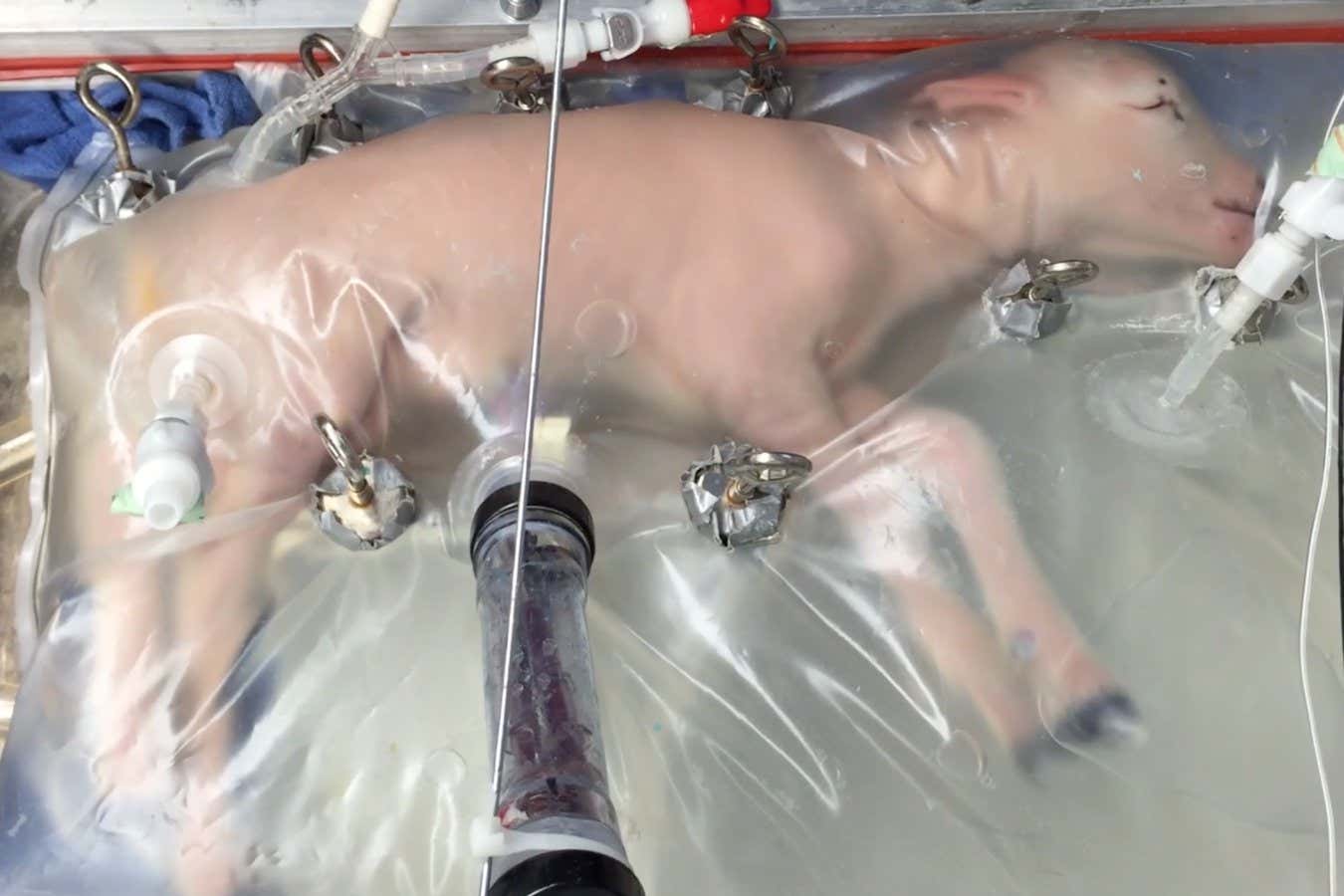 Premature babies could be treated with an artificial uterus in 2024