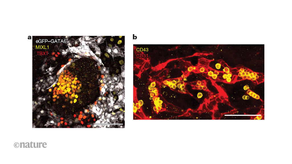 A human embryo model mimics early development and blood-cell formation