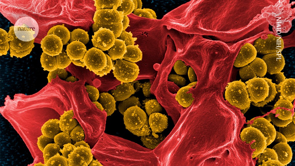 ‘brain drain’ is derailing the fight to stop them