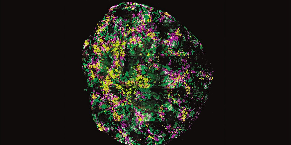 The Download: Organoid uses, and open source voting machines