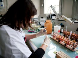 Do bone marrow transplants transmit Alzheimer’s disease? Do bone marrow transplants transmit Alzheimer’s disease?