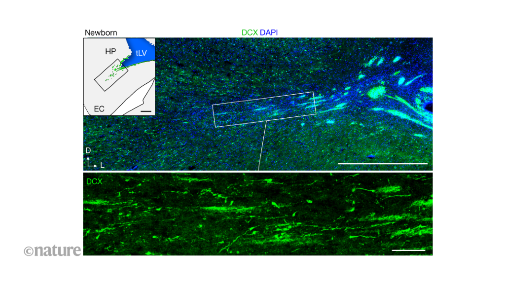 Neuron migration to brain regions key to memory and navigation continues into childhood