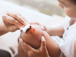 How microbes influence healing and infection risks How microbes influence healing and infection risks