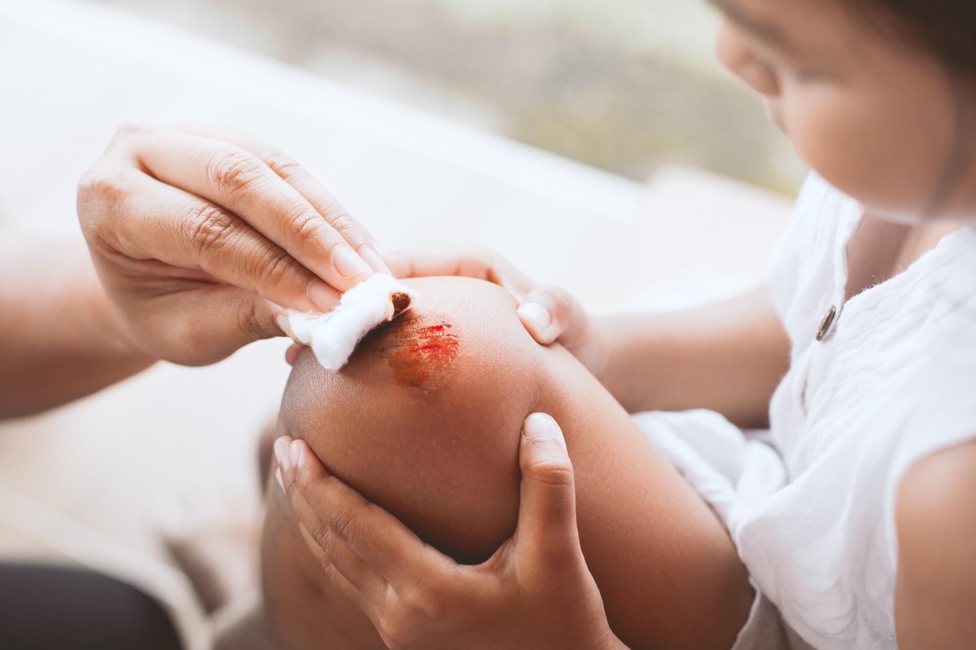 How microbes influence healing and infection risks