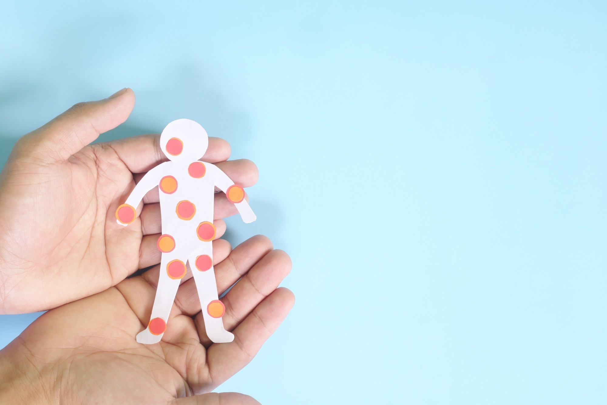 Persistent measles importations challenge U.S. elimination efforts