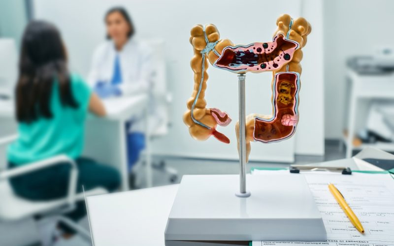 How body shape influences colorectal cancer risk How body shape influences colorectal cancer risk
