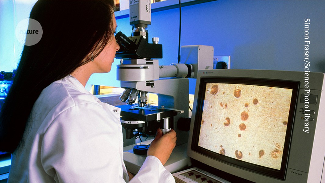 1984: Identifying amyloid-β in brain plaques